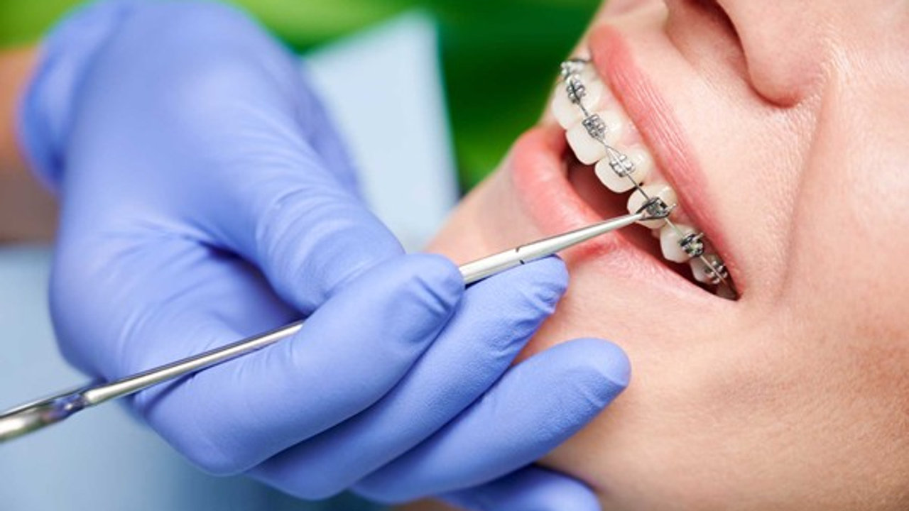 10 Reasons to Choose Orthodontists over Dentists